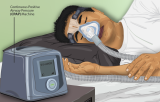 The Ultimate Guide to Fighting Sleep Apnea: Tips, Tricks, and Products